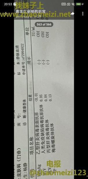 白虎熟妇